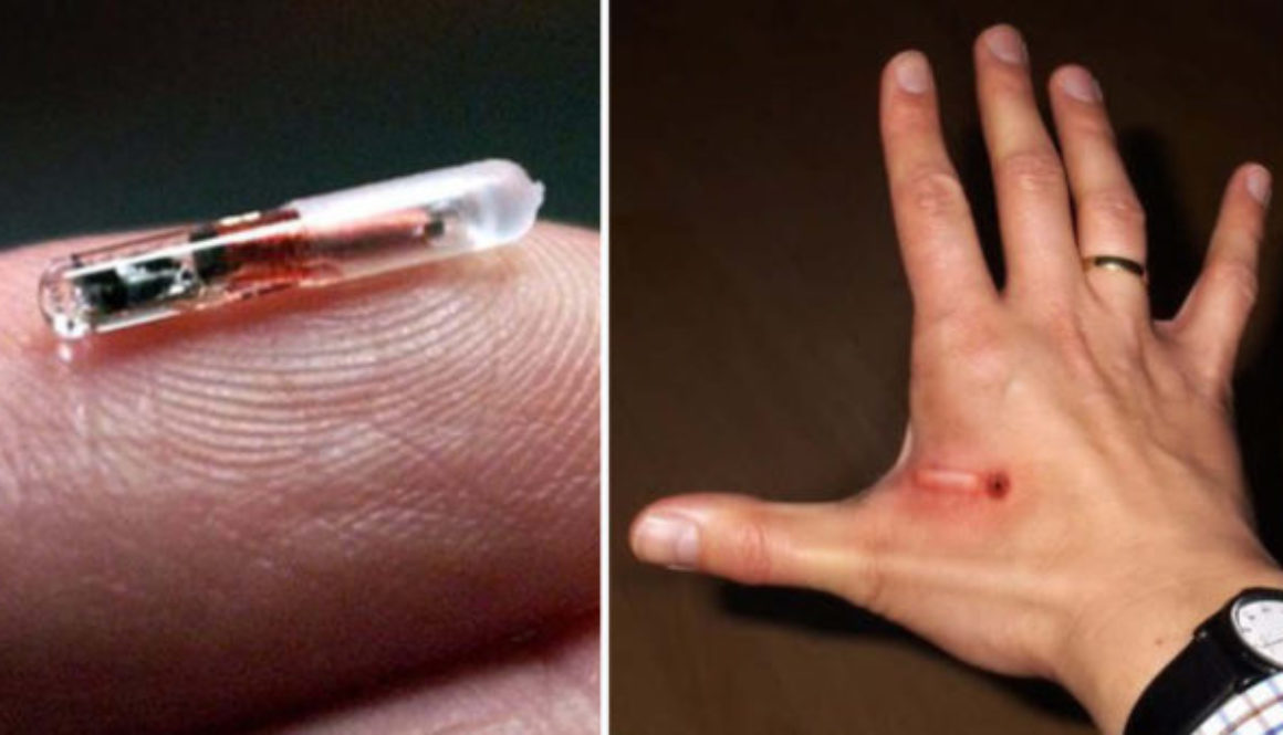 microchip